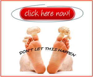 Don`t let toenail fungus afect you
