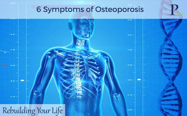 6 Symptoms of Osteoporosis