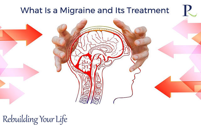 What Is a Migraine and Its Treatment