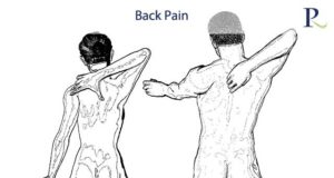 Back Pain