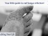 Your little guide to nail fungus infection!