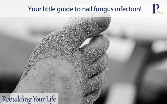 Your little guide to nail fungus infection!