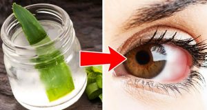 Eye health and how Aloe Vera can help