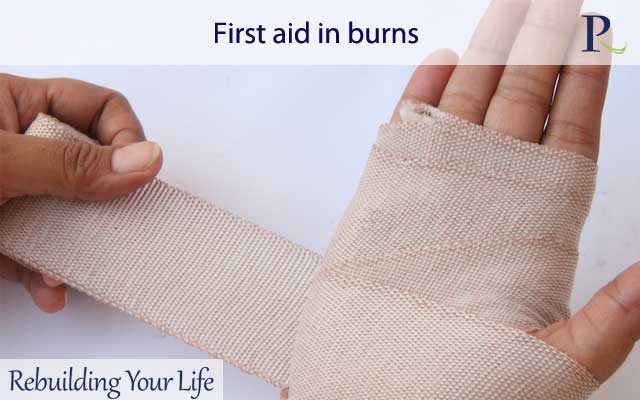 First aid in burns